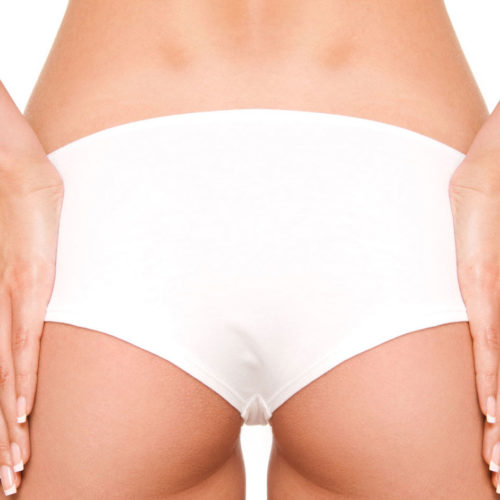 Quali sono le cause della cellulite sui glutei?