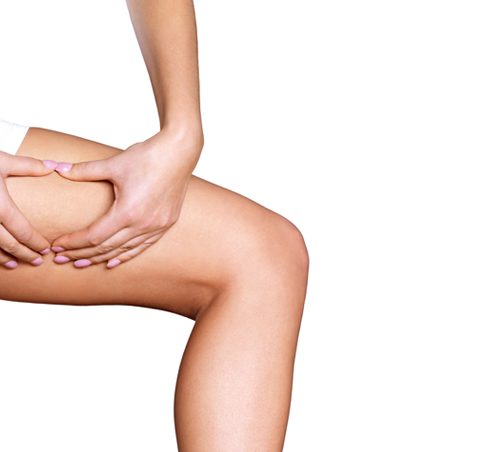 Pressoterapia, trattamento per la cellulite